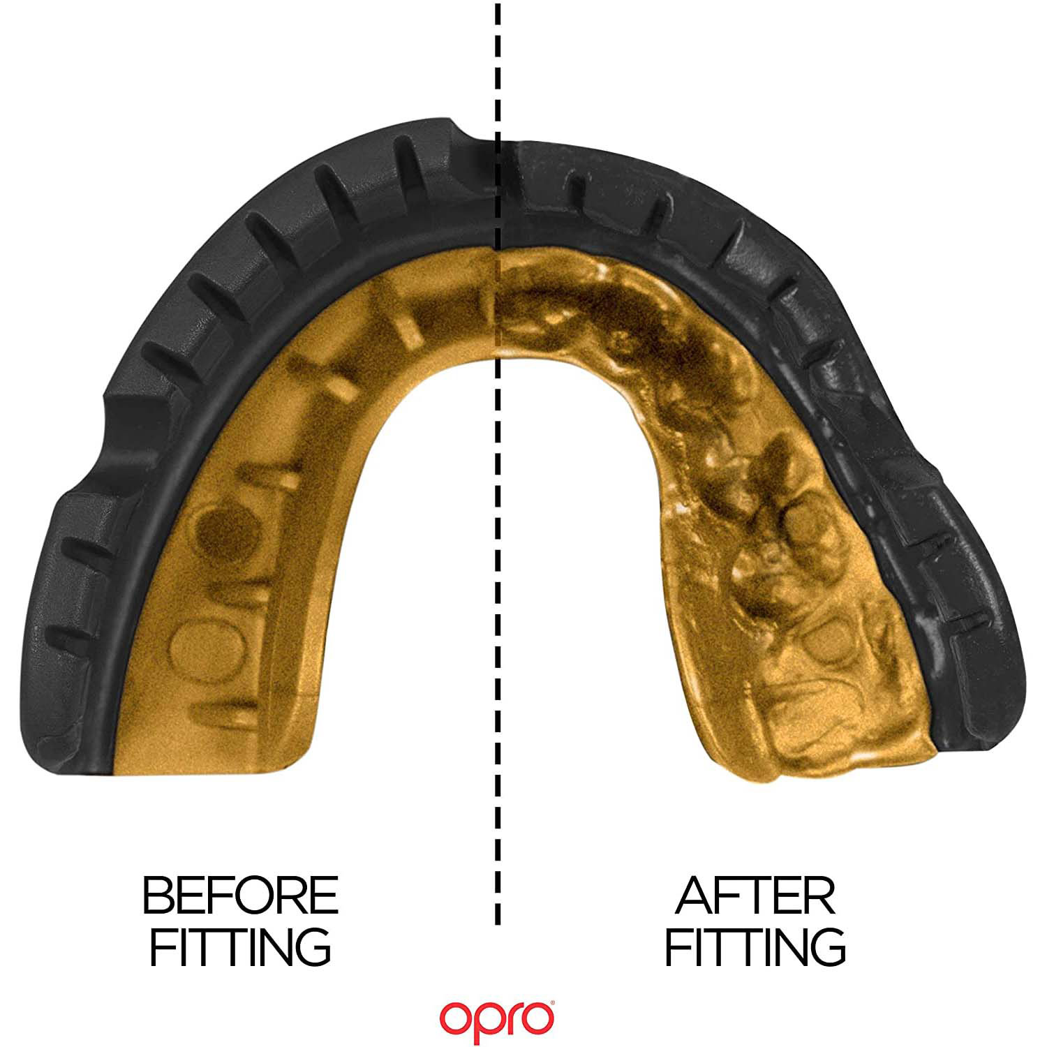 OPRO SELF-FIT MOUTHGUARD FOR BRACES - GOLD LEVEL